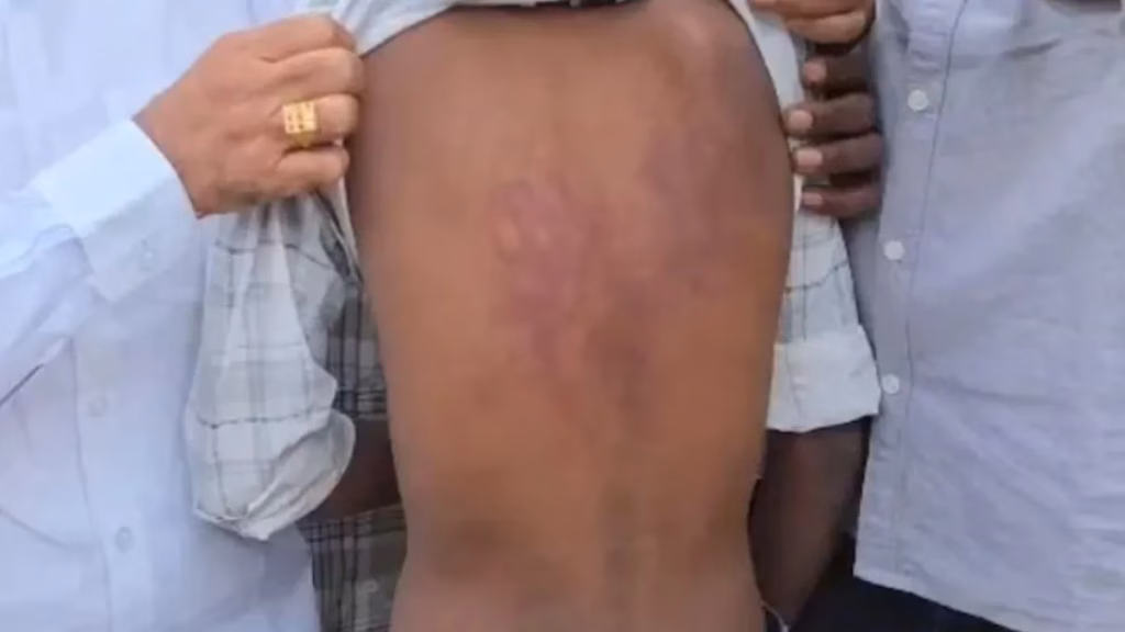 Hyderabad Govt School Horror: Class 7 Student Beaten on Principal’s Orders